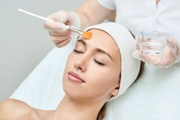 Chemical Peels Treatment